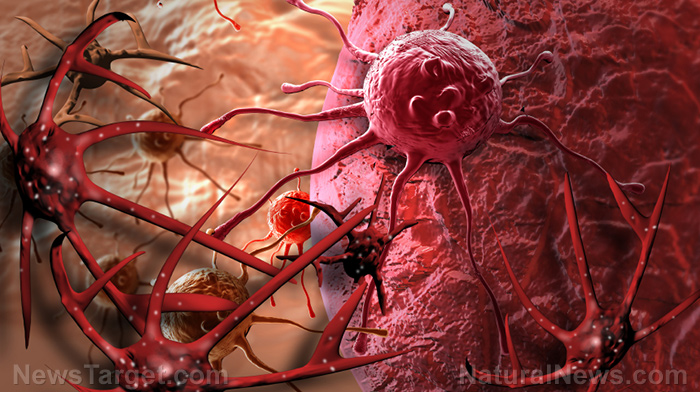 THE VACCINE-CANCER ATROCITY: Like clockwork, most vaccinated Americans will lose immune function by Christmas and start growing accelerated CANCER tumors that will kill them over the next ten years – NaturalNews.com