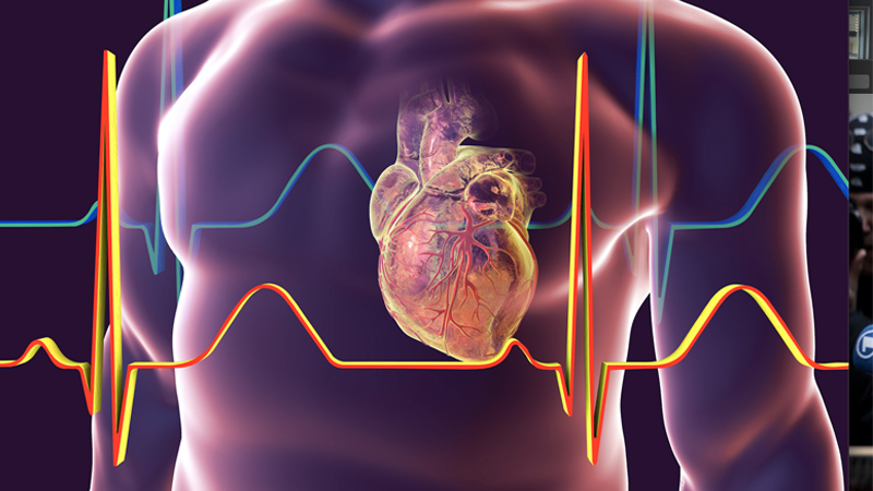 Covid Vaccine Link to Myocarditis Probed by Investigators