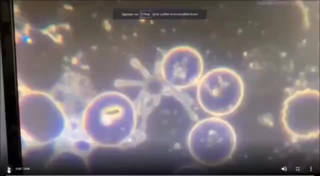 Blood of a vaccinated person: Parasites Hydra Vulgaris