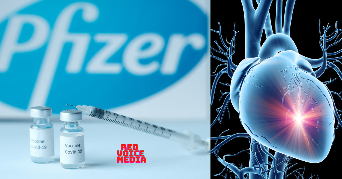 Healthy 27-Year-Old Woman's Heart Damaged By Pfizer Jab; 