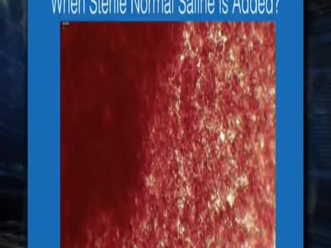 The Pfizer Vaccine - What Happens Inside Your Bloodstream?