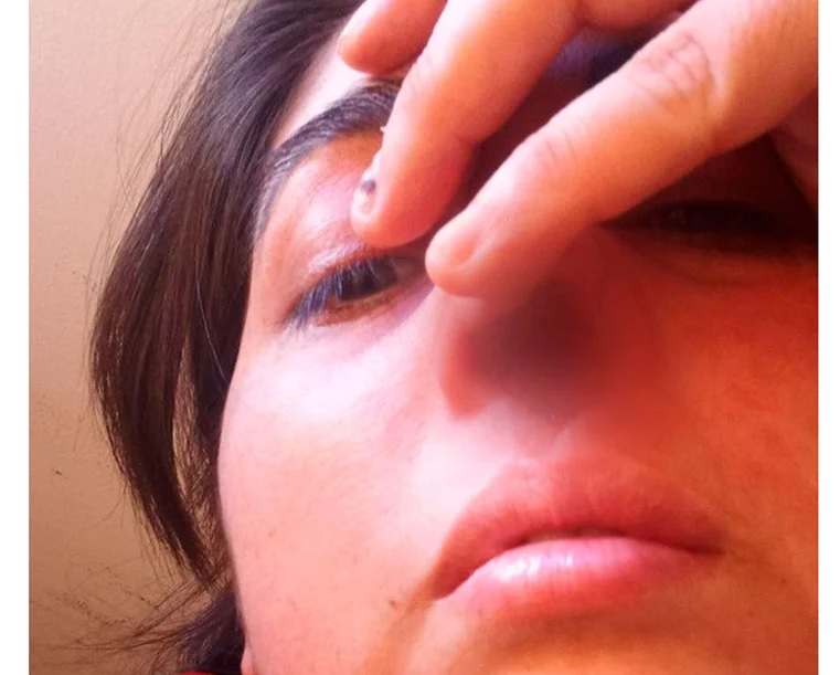 An Argentine woman lost her cartilage to her nose after numerous tests – World-Signals News