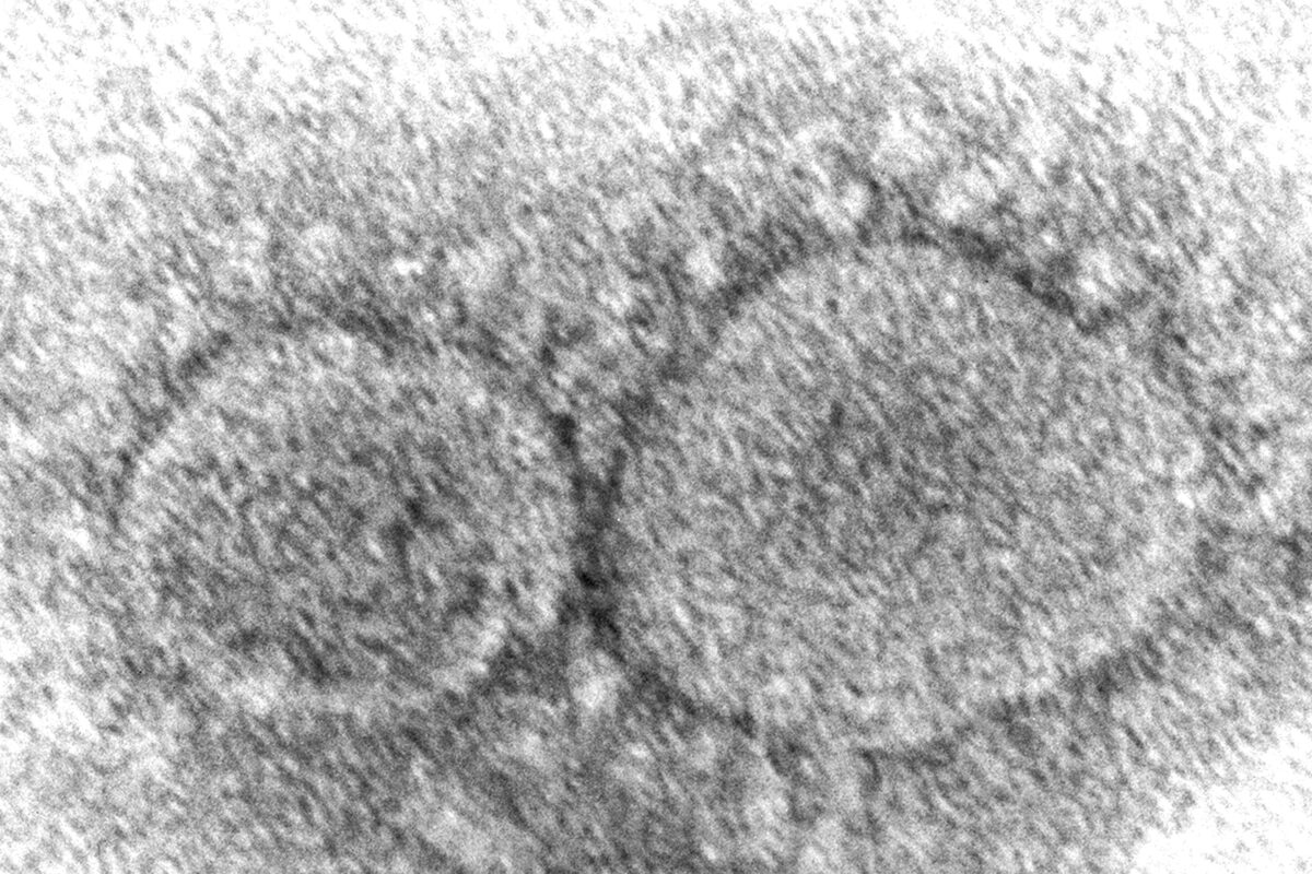 New COVID-19 Sub-Variant Being Investigated, Detected in US