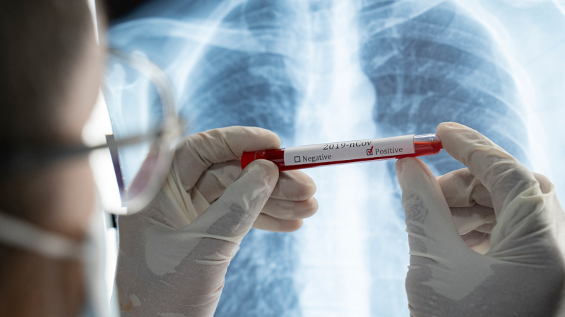 Terrifying VAERS Entry Documents “Unexplained Tumor Growth” in Chest Cavity, Death Less Than 30 Days After Pfizer Vaccine