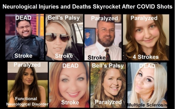 A secret study by the FDA and NIH of vaccine side effects reached a 68,000% increase in strokes – World-Signals News