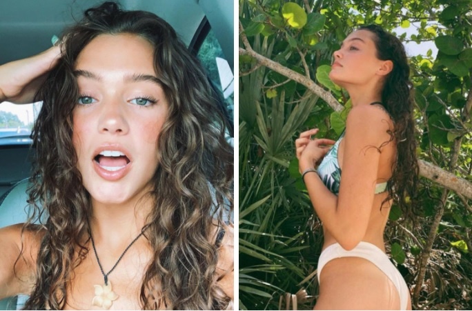 Fully vaccinated young model with two amputated legs – blame the virus for the complications – World-Signals News