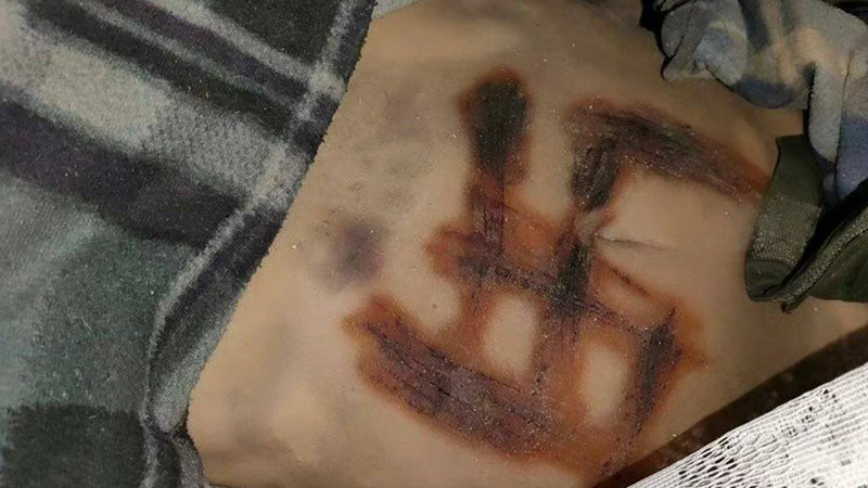 Propaganda? Ukrainian MP Claims Russian Soldiers Burned Swastika Into Woman’s Belly