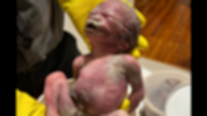 Baby Bodies Recovered from Abortion Clinic Prompt Calls for Investigation