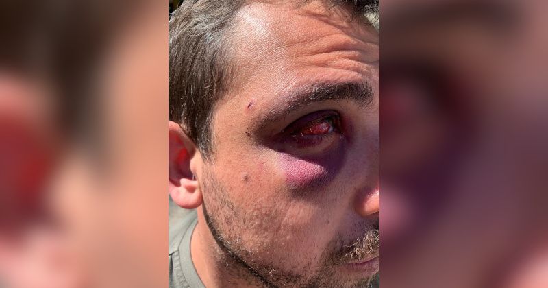 France: Cafe Owners Beaten by Mob of 'Street Kids'