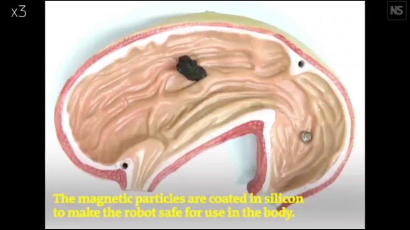 Robots in the human body are a reality – World-Signals News