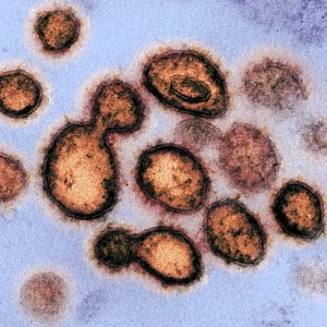 Moderna was found to be the creator of the Covid-19 Virus, according to documents. - The Liberty Loft