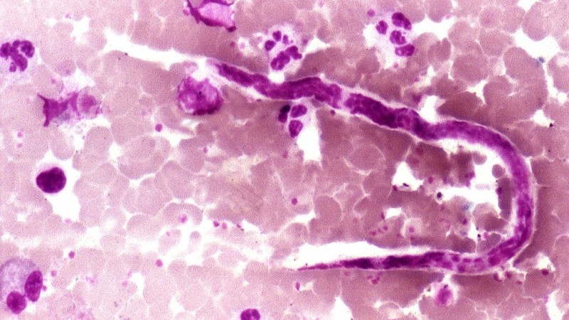 ‘Sexism’ Row Erupts Over Not Enough Parasitic Worms Being Named After Female Scientists