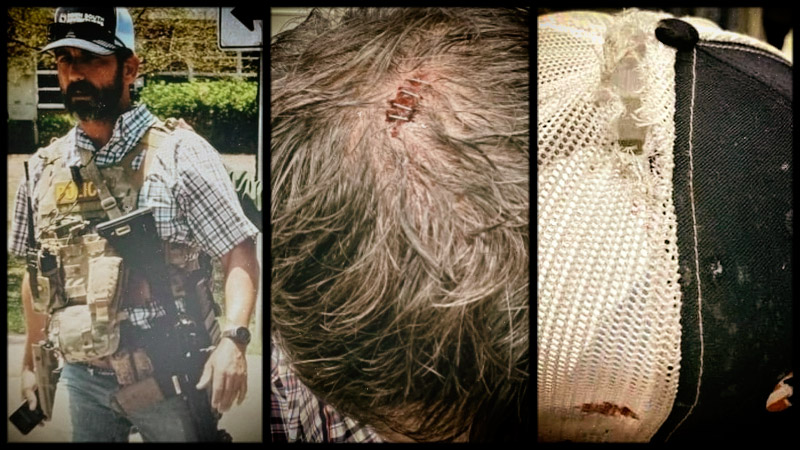 Photos: Bullet Grazed Head of Hero Border Patrol Agent Who Went on ‘Suicide Mission’ to Kill Uvalde Shooter