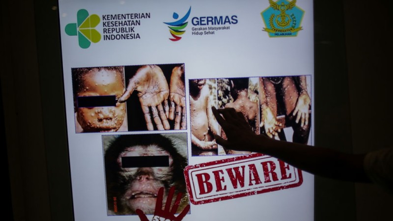 WHO Warns Summer Festivals, Mass Gatherings Could Accelerate Spread of Monkeypox