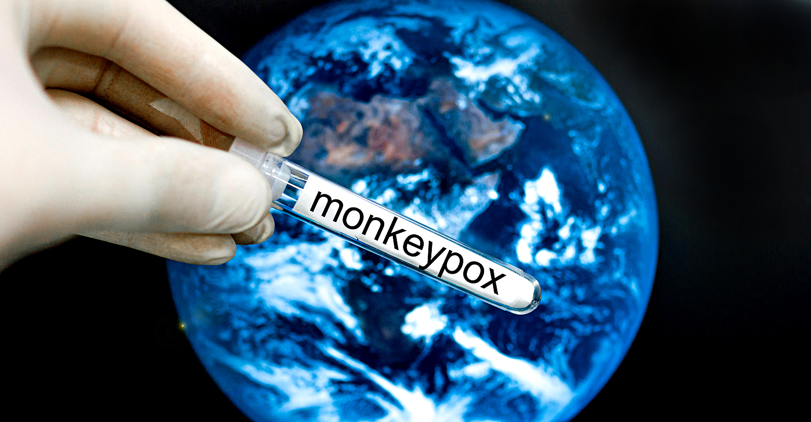 As Monkeypox Cases Spread, Report Shows Gates Foundation, WHO, Pharma Execs Took Part in Monkeypox Pandemic ‘Simulation’ • Children's Health Defense