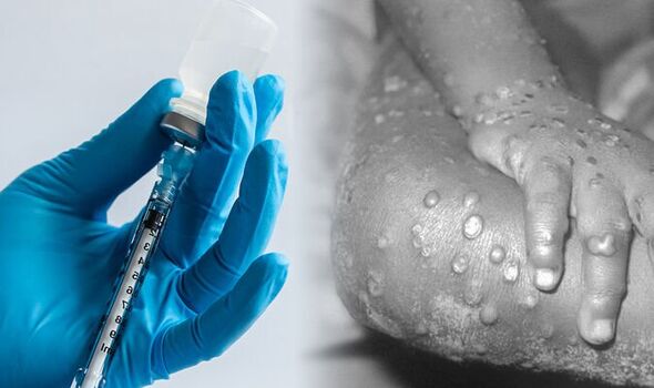The first vaccinations against monkeypox have already begun – World-Signals News