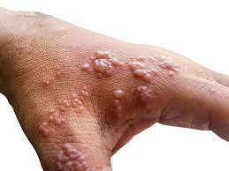 A new mysterious disease is spreading in the UK with a 10% mortality rate – World-Signals News