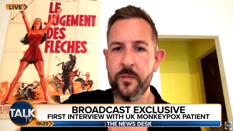 Monkeypox Patient Says He Caught Virus After Having Gay Sex With “Around 10 New Partners”