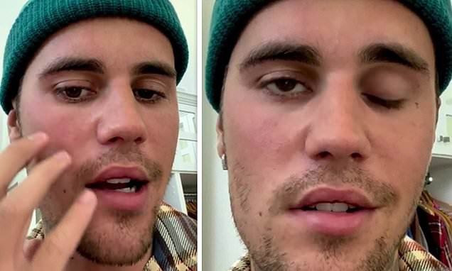 Another celebrity suffers from the side effects of the vaccine – World-Signals News