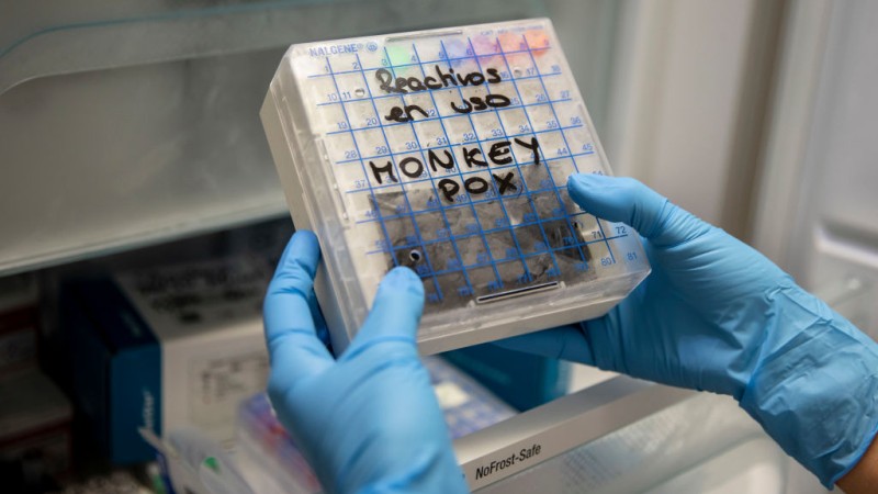UK Health Agency: 99 Per Cent of Monkeypox Cases Are Gay Men