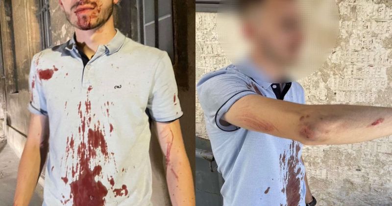 Off-Duty Cops Ambushed by Mob at French Nightclub