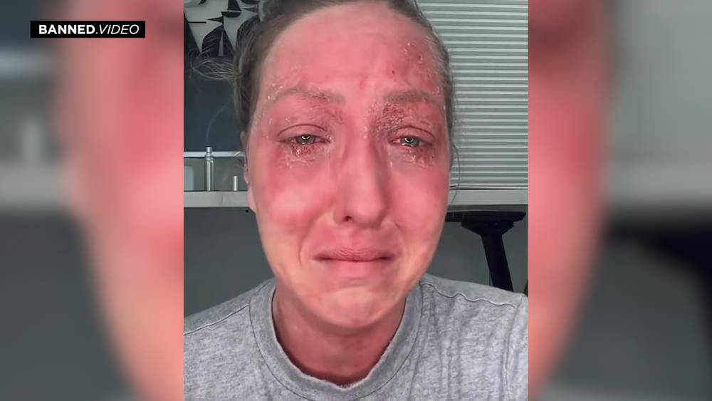 TMW You Realize, You Should Not Have Trusted The System: Vaxx Damage Victim