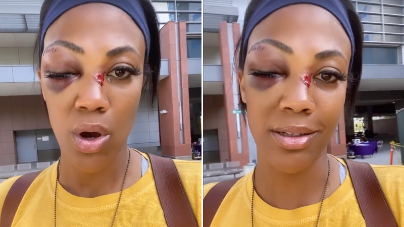 Olympic Athlete Brutally Beaten by Armed Vagrant in LA – NewsWars