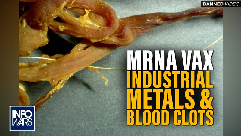 Bombshell: Lab Tests Connect MRNA Vax With Industrial Metals & Blood Clots