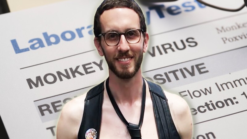 Wiener Says Gays Shouldn’t Avoid Sex Party Orgies Despite Monkeypox