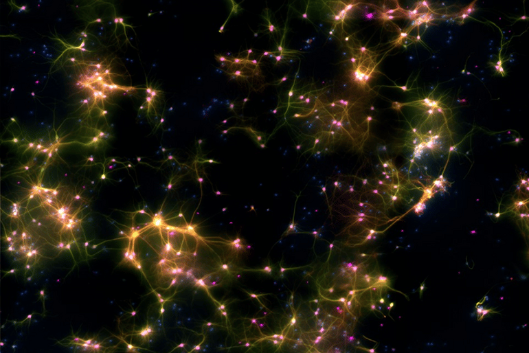 Human Brain Cells in a Dish Learn to Play Pong - Neuroscience News