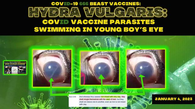 COVID-19 666 Vaccines: Hydra Vulgaris Vaccine Parasites Swimming In Young Boy’s Eye - 1-4-2023