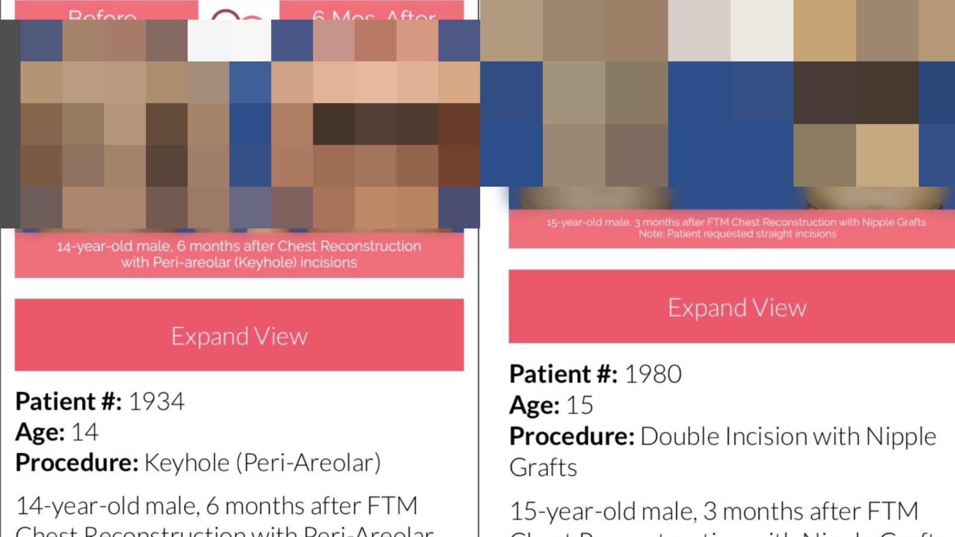 North Carolina Cosmetic Surgery Clinic Reportedly Operated On 14 Year Old 