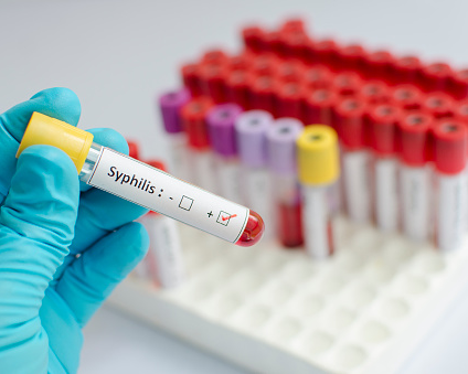 Czech Republic sees decade-high surge in syphilis cases | Voice of Europe