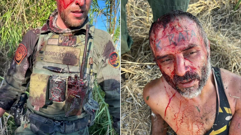 Border Patrol Agent Bloodied in Attack by Illegal With “RAT” Tattooed on Head
