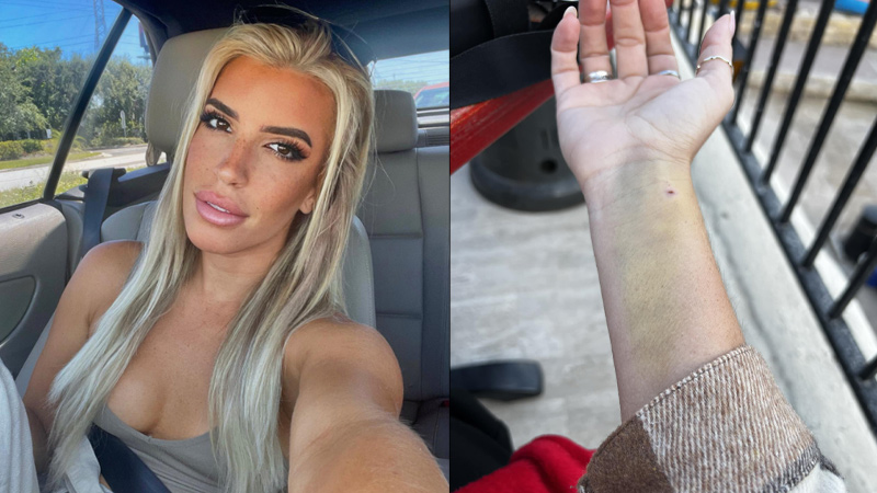 Influencer Blasts Covid Jab After Cardiologists Claim Responsible for Heart Attack