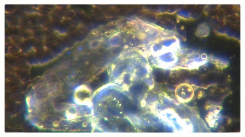 Self-Replicating Nanobots Found in Both Vaxxed & UnVaxxed