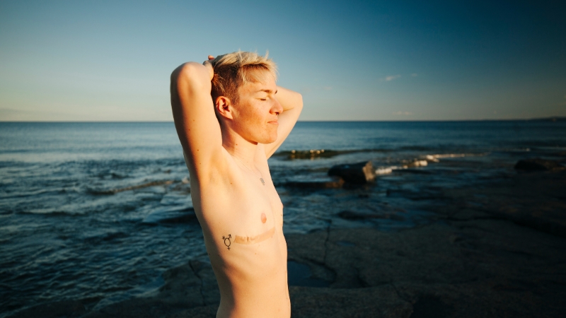 People Who Undergo Gender-Reassignment Surgery Have a 12x Increased Risk of Suicide