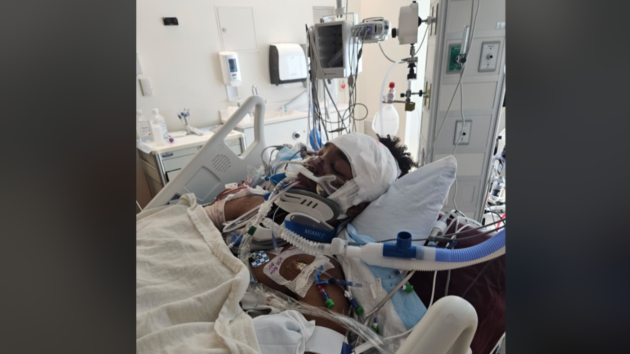 22-year-old in critical condition after hit-and-run | FOX 5 DC