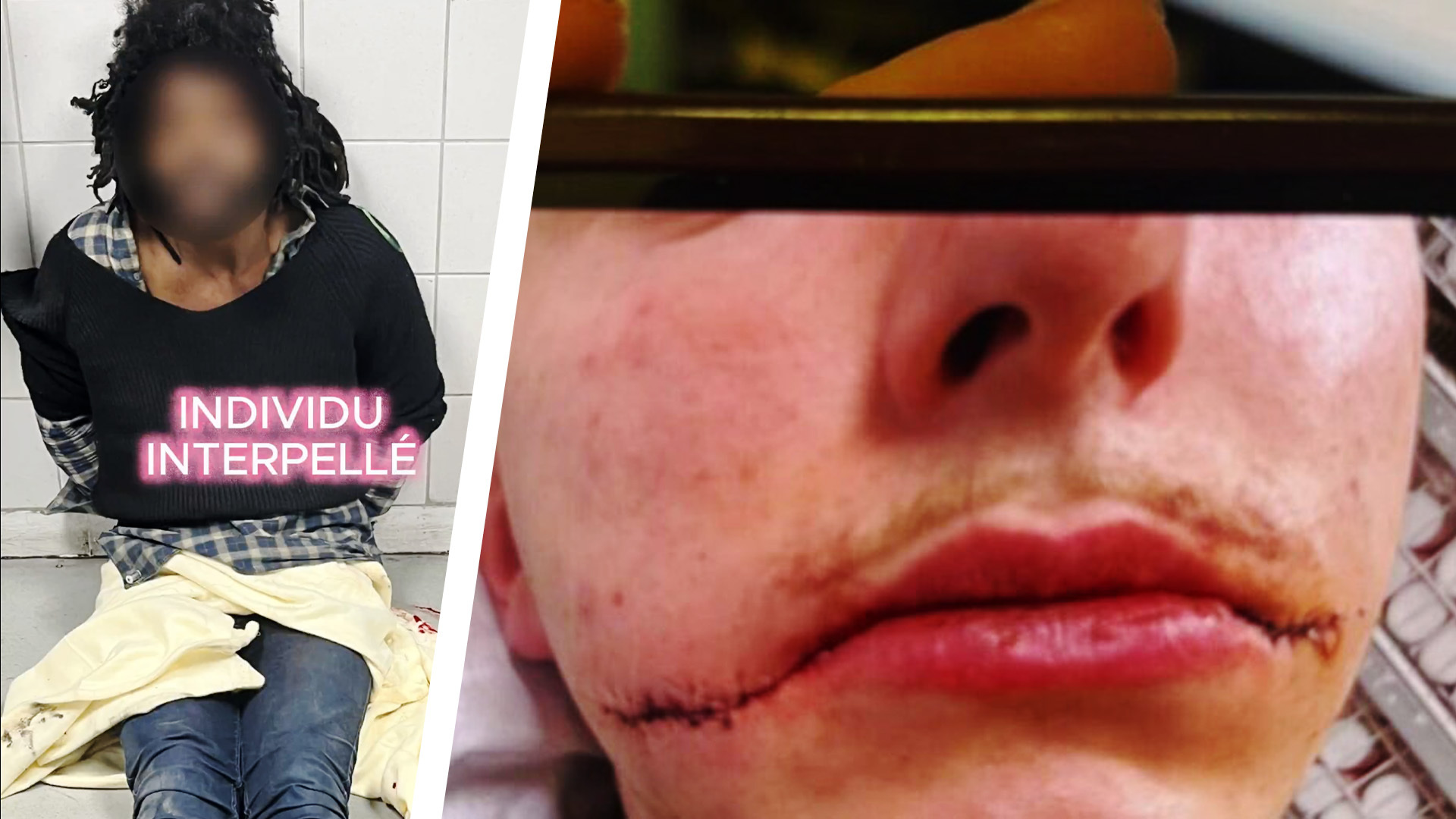 EU censors story of French youth Killian having his face carved into the 'Joker's smile' by a homeless Caribbean migrant in Paris